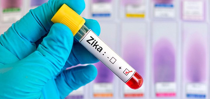 Microcefalia: remédio pode evitar transmissão do Zika para bebê Saúde de A a Z 