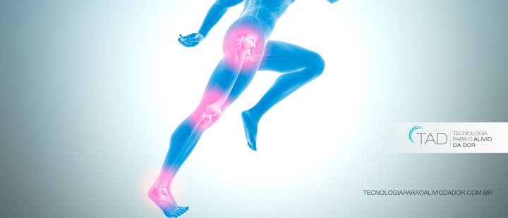 Conheça as causas e como tratar a dor nas pernas Saúde de A a Z  
