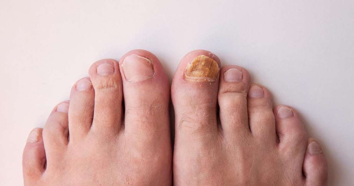 Unhas saudáveis e bem cuidadas com diferentes texturas e cores