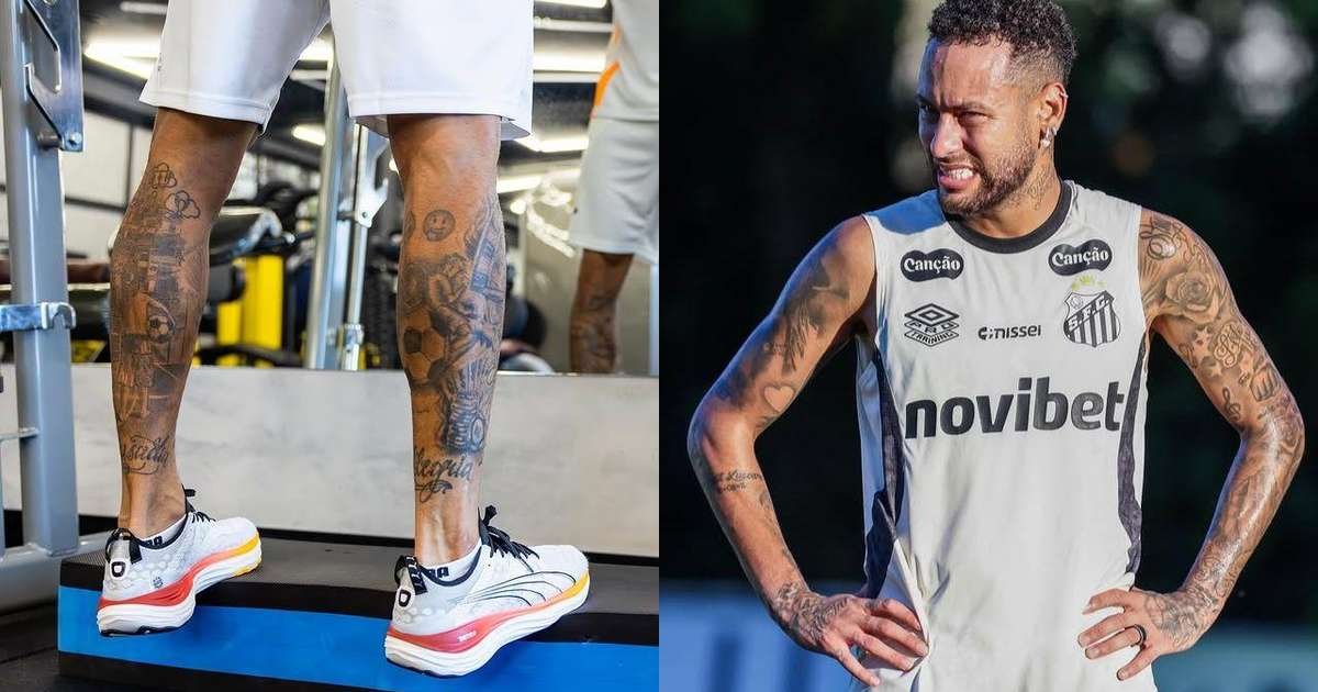 Inchaço na panturrilha de atleta, representando o edema que acometeu Neymar